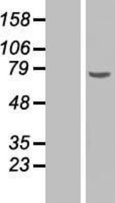 Western Blot: Chk2 Overexpression Lysate (Adult Normal) [NBP2-10753] Left-Empty vector transfected control cell lysate (HEK293 cell lysate); Right -Over-expression Lysate for Chk2.
