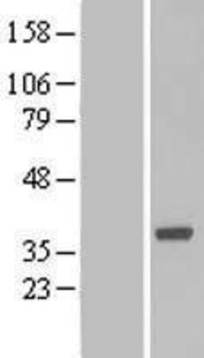 Western Blot: Boll Overexpression Lysate (Adult Normal) [NBL1-08018] Left-Empty vector transfected control cell lysate (HEK293 cell lysate); Right -Over-expression Lysate for Boll.