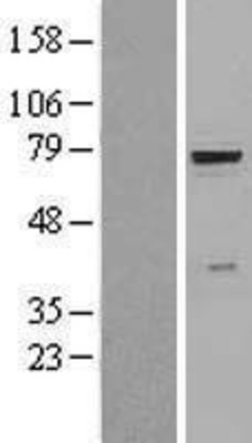 Western Blot: beta Glucuronidase Overexpression Lysate (Adult Normal) [NBL1-11412] Left-Empty vector transfected control cell lysate (HEK293 cell lysate); Right -Over-expression Lysate for beta Glucuronidase.
