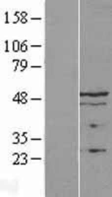 Western Blot: LAP2 Overexpression Lysate (Adult Normal) [NBL1-17119] Left-Empty vector transfected control cell lysate (HEK293 cell lysate); Right -Over-expression Lysate for LAP2.