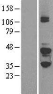 Western Blot: G Protein alpha z Overexpression Lysate (Adult Normal) [NBL1-11163] Left-Empty vector transfected control cell lysate (HEK293 cell lysate); Right -Over-expression Lysate for G Protein alpha z.