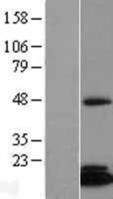 Western Blot: CGI-128 Overexpression Lysate (Adult Normal) [NBL1-10584] Left-Empty vector transfected control cell lysate (HEK293 cell lysate); Right -Over-expression Lysate for CGI-128.
