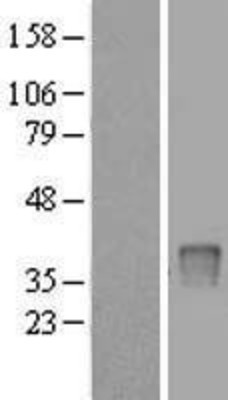 Western Blot: UPP2 Overexpression Lysate (Adult Normal) [NBL1-17626] Left-Empty vector transfected control cell lysate (HEK293 cell lysate); Right -Over-expression Lysate for UPP2.