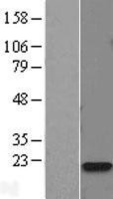 Western Blot: Calmodulin 2 Overexpression Lysate (Adult Normal) [NBL1-08650] Left-Empty vector transfected control cell lysate (HEK293 cell lysate); Right -Over-expression Lysate for Calmodulin 2.
