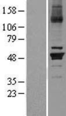 Western Blot: Cytochrome P450 26B1 Overexpression Lysate (Adult Normal) [NBL1-09680] Left-Empty vector transfected control cell lysate (HEK293 cell lysate); Right -Over-expression Lysate for Cytochrome P450 26B1.