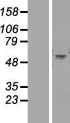Western Blot: Nicotinic Acetylcholine Receptor alpha 1 Overexpression Lysate (Adult Normal) [NBP2-10611] Left-Empty vector transfected control cell lysate (HEK293 cell lysate); Right -Over-expression Lysate for Nicotinic Acetylcholine Receptor alpha 1.
