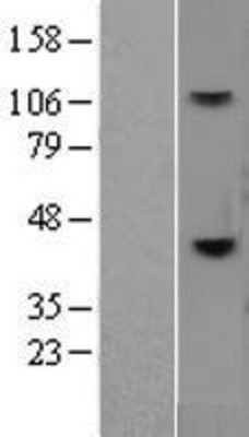 Western Blot: CD38 Overexpression Lysate (Adult Normal) [NBL1-08942] Left-Empty vector transfected control cell lysate (HEK293 cell lysate); Right -Over-expression Lysate for CD38.