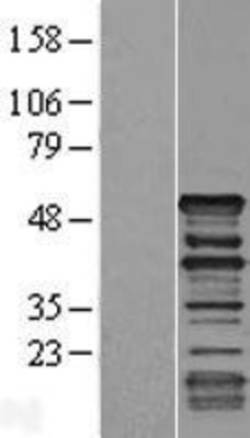 Western Blot: Dematin Overexpression Lysate (Adult Normal) [NBP2-10790] Left-Empty vector transfected control cell lysate (HEK293 cell lysate); Right -Over-expression Lysate for Dematin.