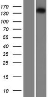 Western Blot: Isoleucyl tRNA synthetase Overexpression Lysate (Adult Normal) [NBP2-10809] Left-Empty vector transfected control cell lysate (HEK293 cell lysate); Right -Over-expression Lysate for Isoleucyl tRNA synthetase.