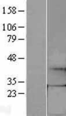 Western Blot: GCH1 Overexpression Lysate (Adult Normal) [NBL1-11007] Left-Empty vector transfected control cell lysate (HEK293 cell lysate); Right -Over-expression Lysate for GCH1.