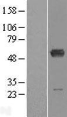Western Blot: ALDH6A1 Overexpression Lysate (Adult Normal) [NBL1-07457] Left-Empty vector transfected control cell lysate (HEK293 cell lysate); Right -Over-expression Lysate for ALDH6A1.