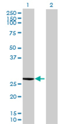 Lane 1: STARD5 transfected lysate (23.54 KDa) Lane 2: Non-transfected lysate.