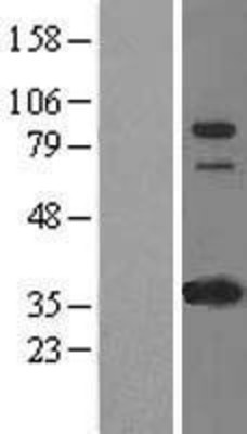 Western Blot: IFI16 Overexpression Lysate (Adult Normal) [NBL1-11826] Left-Empty vector transfected control cell lysate (HEK293 cell lysate); Right -Over-expression Lysate for IFI16.