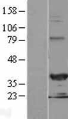 Western Blot: HEY2 Overexpression Lysate (Adult Normal) [NBL1-11522] Left-Empty vector transfected control cell lysate (HEK293 cell lysate); Right -Over-expression Lysate for HEY2.