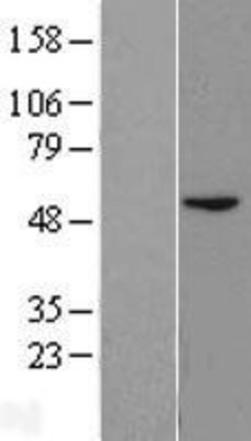 Western Blot: BLMH Overexpression Lysate (Adult Normal) [NBL1-07990] Left-Empty vector transfected control cell lysate (HEK293 cell lysate); Right -Over-expression Lysate for BLMH.