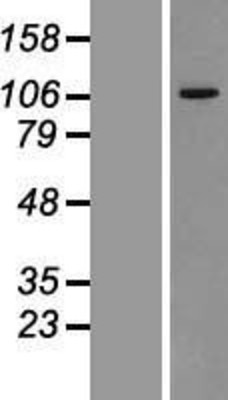 Western Blot: VPS11 Overexpression Lysate (Adult Normal) [NBL1-17736] Left-Empty vector transfected control cell lysate (HEK293 cell lysate); Right -Over-expression Lysate for VPS11.