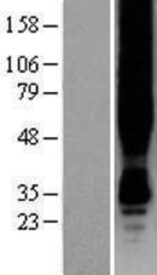 Western Blot: GPR30 Overexpression Lysate (Adult Normal) [NBP2-10927] Left-Empty vector transfected control cell lysate (HEK293 cell lysate); Right -Over-expression Lysate for GPR30.