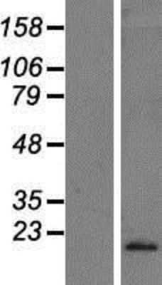 Western Blot: Interferon alpha 10 Overexpression Lysate (Adult Normal) [NBP2-10810] Left-Empty vector transfected control cell lysate (HEK293 cell lysate); Right -Over-expression Lysate for Interferon alpha 10.
