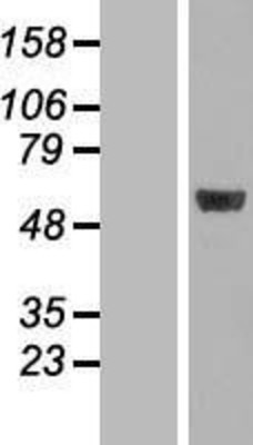 Western Blot: MINA53 Overexpression Lysate (Adult Normal) [NBP2-10899] Left-Empty vector transfected control cell lysate (HEK293 cell lysate); Right -Over-expression Lysate for MINA53.