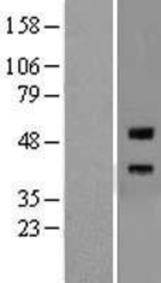 Western Blot: Repulsive Guidance Molecule A Overexpression Lysate (Adult Normal) [NBL1-15315] Left-Empty vector transfected control cell lysate (HEK293 cell lysate); Right -Over-expression Lysate for Repulsive Guidance Molecule A.