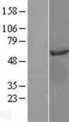 Western Blot: AKT3 Overexpression Lysate (Adult Normal) [NBL1-07443] Left-Empty vector transfected control cell lysate (HEK293 cell lysate); Right -Over-expression Lysate for AKT3.