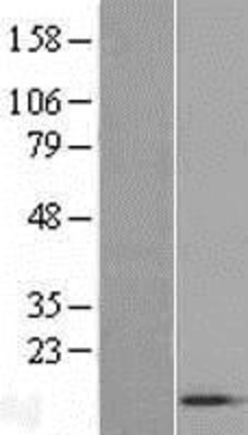 Western Blot: ACYP1 Overexpression Lysate (Adult Normal) [NBL1-07302] Left-Empty vector transfected control cell lysate (HEK293 cell lysate); Right -Over-expression Lysate for ACYP1.