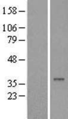 Western Blot: FAM98B Overexpression Lysate (Adult Normal) [NBL1-10585] Left-Empty vector transfected control cell lysate (HEK293 cell lysate); Right -Over-expression Lysate for FAM98B.