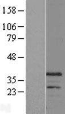 Western Blot: CHRFAM7A Overexpression Lysate (Adult Normal) [NBL1-09172] Left-Empty vector transfected control cell lysate (HEK293 cell lysate); Right -Over-expression Lysate for CHRFAM7A.