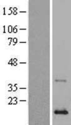 Western Blot: Phospholipase A2 IIA Overexpression Lysate (Adult Normal) [NBL1-14472] Left-Empty vector transfected control cell lysate (HEK293 cell lysate); Right -Over-expression Lysate for Phospholipase A2 IIA.