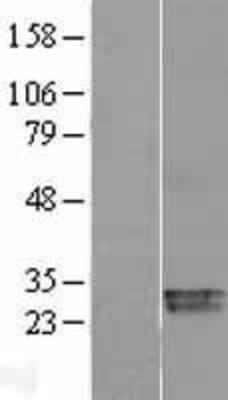 Western Blot: Superoxide Dismutase 3 Overexpression Lysate (Adult Normal) [NBL1-16335] Left-Empty vector transfected control cell lysate (HEK293 cell lysate); Right -Over-expression Lysate for Superoxide Dismutase 3.