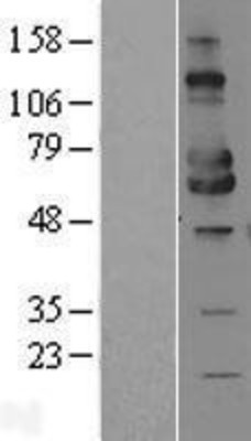 Western Blot: MICA Overexpression Lysate (Adult Normal) [NBL1-13098] Left-Empty vector transfected control cell lysate (HEK293 cell lysate); Right -Over-expression Lysate for MICA.