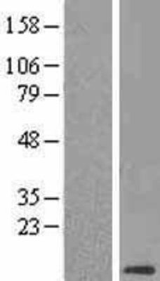 Western Blot: CLPS Overexpression Lysate (Adult Normal) [NBL1-09280] Left-Empty vector transfected control cell lysate (HEK293 cell lysate); Right -Over-expression Lysate for CLPS.