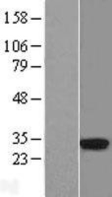 Western Blot: HLA DRA Overexpression Lysate (Adult Normal) [NBL1-11590] Left-Empty vector transfected control cell lysate (HEK293 cell lysate); Right -Over-expression Lysate for HLA DRA.