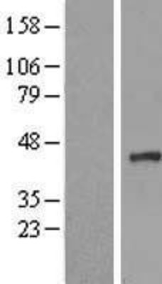 Western Blot: NUDT9 Overexpression Lysate (Adult Normal) [NBL1-13868] Left-Empty vector transfected control cell lysate (HEK293 cell lysate); Right -Over-expression Lysate for NUDT9.
