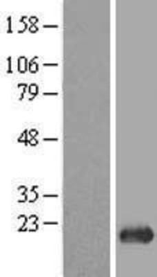 Western Blot: RPP20 Overexpression Lysate (Adult Normal) [NBL1-14608] Left-Empty vector transfected control cell lysate (HEK293 cell lysate); Right -Over-expression Lysate for RPP20.