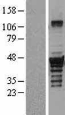 Western Blot: Dysbindin Overexpression Lysate (Adult Normal) [NBL1-10034] Left-Empty vector transfected control cell lysate (HEK293 cell lysate); Right -Over-expression Lysate for Dysbindin.