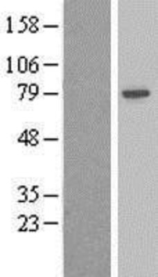 Western Blot: beta Adducin Overexpression Lysate (Adult Normal) [NBL1-07331] Left-Empty vector transfected control cell lysate (HEK293 cell lysate); Right -Over-expression Lysate for beta Adducin.