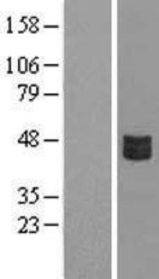Western Blot: CRLF3 Overexpression Lysate (Adult Normal) [NBL1-09486] Left-Empty vector transfected control cell lysate (HEK293 cell lysate); Right -Over-expression Lysate for CRLF3.