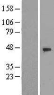 Western Blot: DCAF4 Overexpression Lysate (Adult Normal) [NBL1-17796] Left-Empty vector transfected control cell lysate (HEK293 cell lysate); Right -Over-expression Lysate for DCAF4.