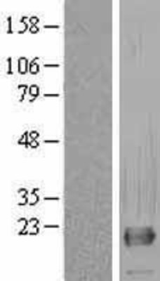 Western Blot: RNF11 Overexpression Lysate (Adult Normal) [NBL1-15408] Left-Empty vector transfected control cell lysate (HEK293 cell lysate); Right -Over-expression Lysate for RNF11.