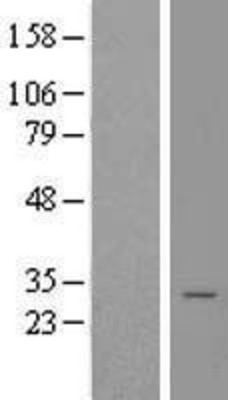 Western Blot: Calneuron 1 Overexpression Lysate (Adult Normal) [NBL1-08654] Left-Empty vector transfected control cell lysate (HEK293 cell lysate); Right -Over-expression Lysate for Calneuron 1.