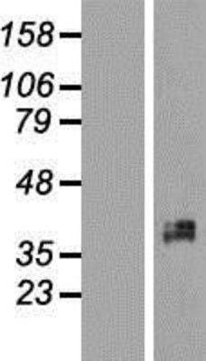 Western Blot: XRCC2 Overexpression Lysate (Adult Normal) [NBL1-17914] Left-Empty vector transfected control cell lysate (HEK293 cell lysate); Right -Over-expression Lysate for XRCC2.