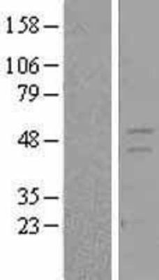 Western Blot: Retinoid X Receptor gamma Overexpression Lysate (Adult Normal) [NBL1-15643] Left-Empty vector transfected control cell lysate (HEK293 cell lysate); Right -Over-expression Lysate for Retinoid X Receptor gamma.