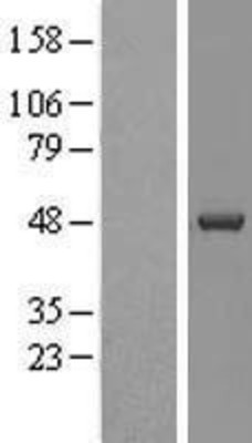 Western Blot: Casein Kinase 1 delta Overexpression Lysate (Adult Normal) [NBL1-09530] Left-Empty vector transfected control cell lysate (HEK293 cell lysate); Right -Over-expression Lysate for Casein Kinase 1 delta.
