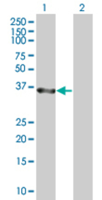 Lane 1: ANKRD1 transfected lysate (35.2 KDa). Lane 2: Non-transfected lysate.