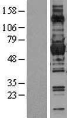 Western Blot: Glucose 6 Phosphate Dehydrogenase Overexpression Lysate (Adult Normal) [NBL1-10899] Left-Empty vector transfected control cell lysate (HEK293 cell lysate); Right -Over-expression Lysate for Glucose 6 Phosphate Dehydrogenase.