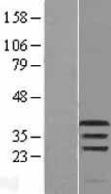 Western Blot: PIM1 Overexpression Lysate (Adult Normal) [NBL1-14426] Left-Empty vector transfected control cell lysate (HEK293 cell lysate); Right -Over-expression Lysate for PIM1.