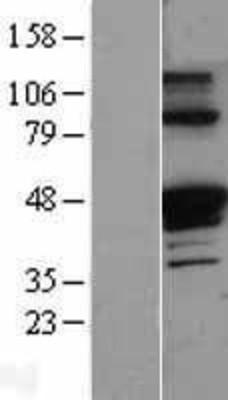 Western Blot: alpha 1 Antitrypsin Overexpression Lysate (Adult Normal) [NBP2-11136] Left-Empty vector transfected control cell lysate (HEK293 cell lysate); Right -Over-expression Lysate for alpha 1 Antitrypsin.