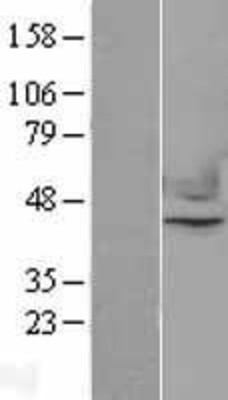 Western Blot: Nuclear Factor Erythroid Derived 2 Overexpression Lysate (Adult Normal) [NBP2-11086] Left-Empty vector transfected control cell lysate (HEK293 cell lysate); Right -Over-expression Lysate for Nuclear Factor Erythroid Derived 2.