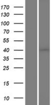 Western Blot: Casein Kinase 1 alpha Overexpression Lysate (Adult Normal) [NBP2-11032] Left-Empty vector transfected control cell lysate (HEK293 cell lysate); Right -Over-expression Lysate for Casein Kinase 1 alpha.